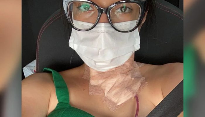 “Não imaginava que seria um câncer”, diz adolescente com tumor na tireoide