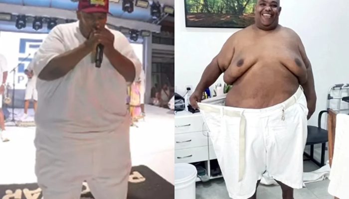 Cantor do Pagodart perde 108 kg e almeja voltar aos palcos após bariátrica