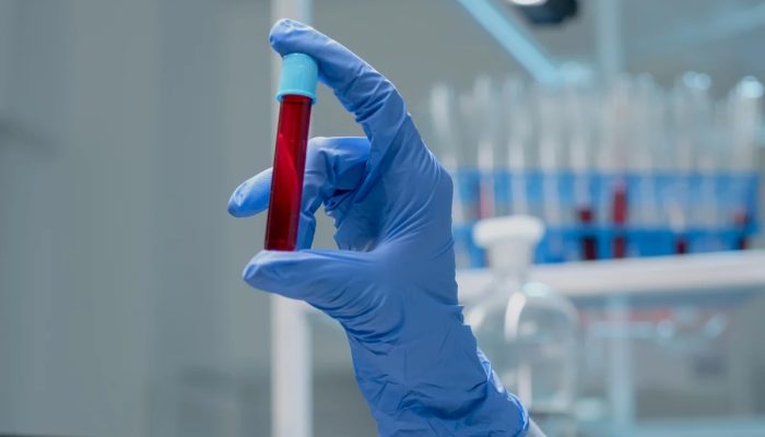 Novo exame de sangue que detecta mais de 50 tipos de câncer chega ao Brasil