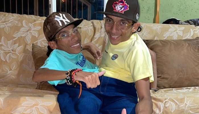 Gêmeos siameses do Equador morrem aos 27 anos na Colômbia